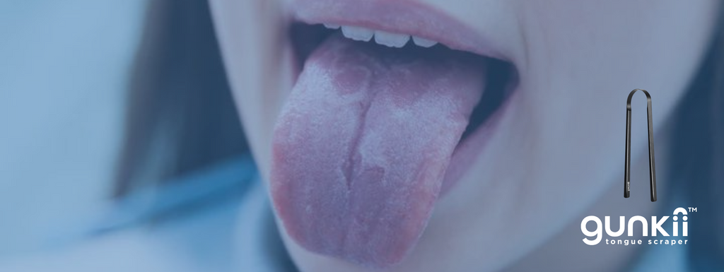 geographic tongue - gunkii luxury tongue scraper