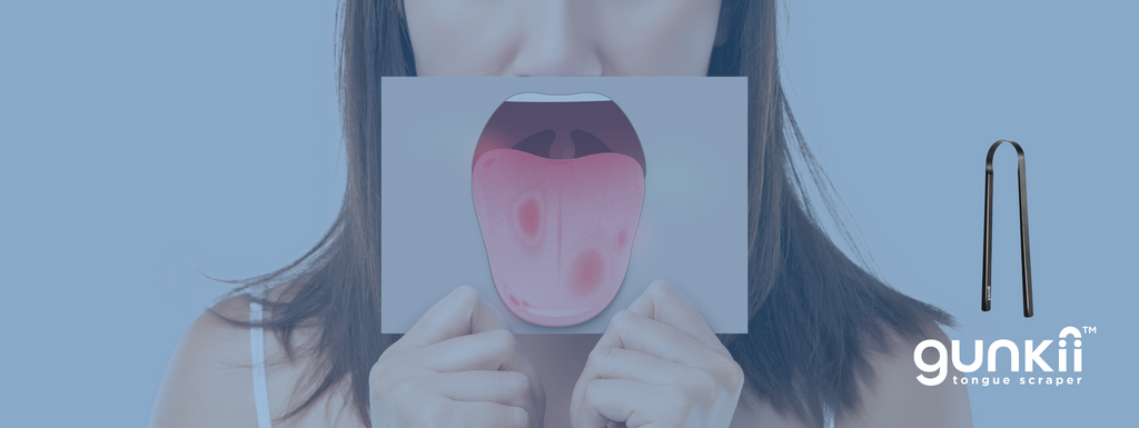 why is my tongue discoloured - gunkii luxury tongue cleaner 